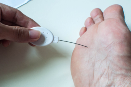 Diabetic foot